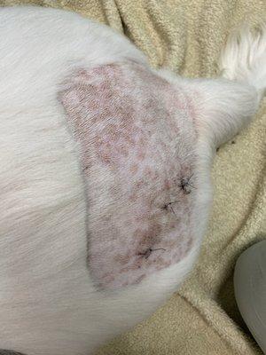 Spots are all infection.  He has 3 ares of stitches from the skin biopsies taken.