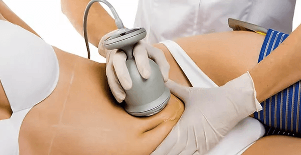 Ultra sound cavitation cellulite reduction treatment