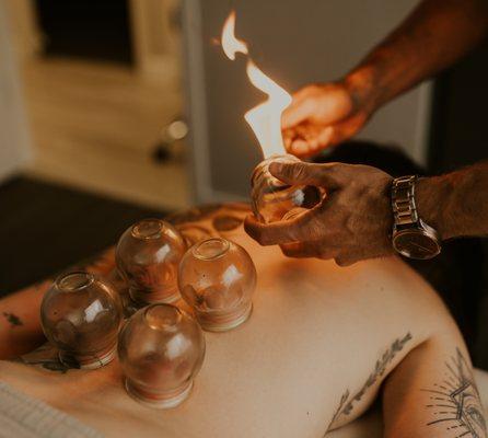 Cupping therapy