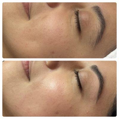 Before and after dermaplaning and brow wax