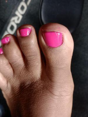 Uneven toenail/cuticle showing