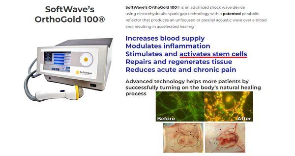 Softwave therapy now available in Irvine. Call 
(949) 222-9171 for details