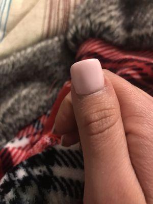 Fat finger nail