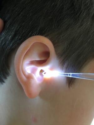 Lighted ear curette - totally cool!