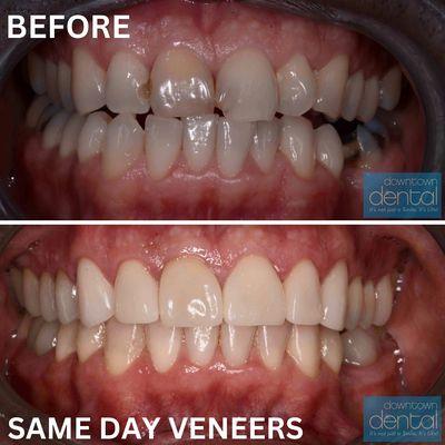 Natural Veneers