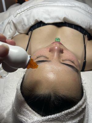 Oxygen Facial