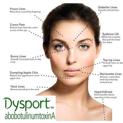 Need help with those wrinkles and fine lines?  Get dysport! Laurie's favorite!!