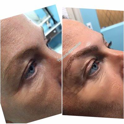 Beautiful transformation. Microblading for blonde hair is no problem.