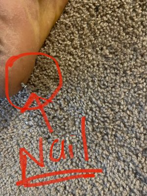 Nail in hubby's foot