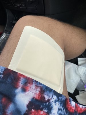 XL bandage / I might of over reacted to the size