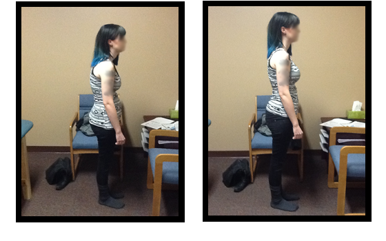 Before and after posture