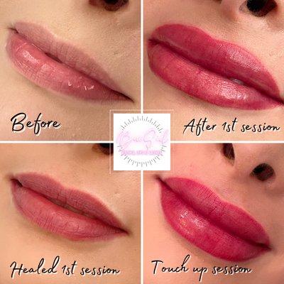 Steps of Lip Blush and healing