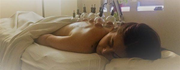 Negative pressure provided by cupping can relax muscles, encourage blood flow, and sedate the nervous system.