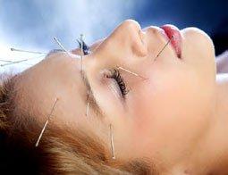 Facial Acupuncture