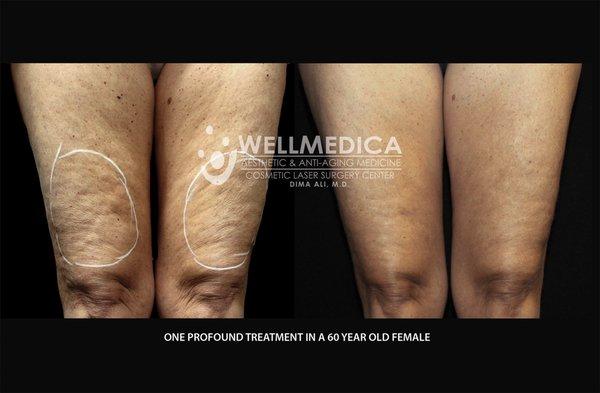 WellMedica Aesthetic & Anti-Aging Medicine - Dr. Dima Ali