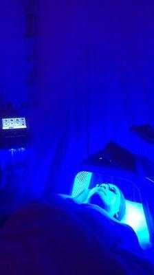 It's my 3rd session of Hydrafacials with Lashnico Esthetics the best!!!!