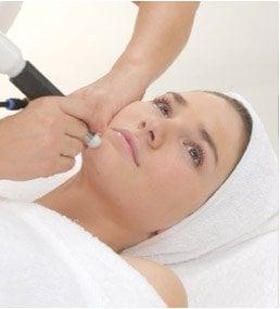 Microdermabrasion