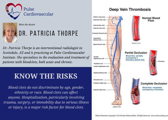 Dr Patricia Thorpe is a renowned expert in Chronic Venous Diseases. Choose the experts for vascular care at Pulse Cardiovascular!