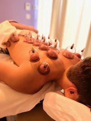 Cupping therapy done on a young football player for back pain.