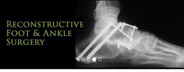 Reconstructive Foot and Ankle Surgery