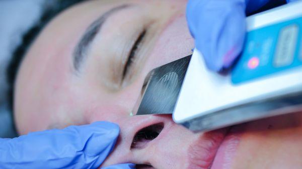 Ultrasonic device to assist in removal of black heads, white head in the skin