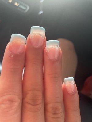 Horrible nails