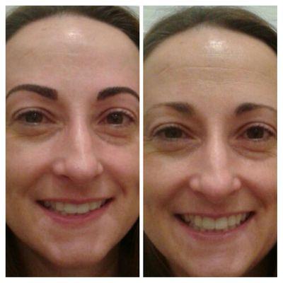 Micro blading eye brow treatment