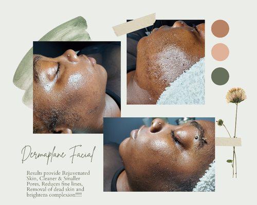 Dermaplaning Facial