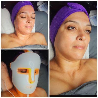 Add LED light therapy to your customized facial to reduce wrinkles, age spots, hyperpigmentation and more !