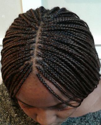 Gallery- Unisex Hairline