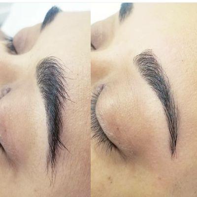 Brow clean up