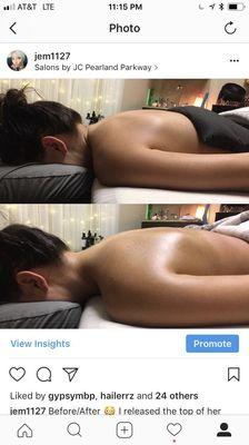 Before and after a deep tissue massage