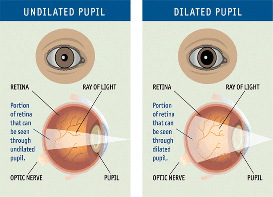 A Dilated eye exam is recommended for all new patients, people suffering from with Diabetes, and anyone over 50 years old.