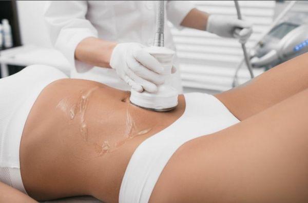 Ultrasound Cavitation Fat Reduction