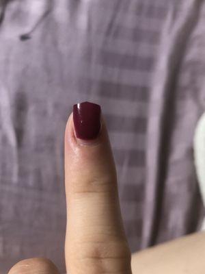 As well as how bad my cuticle looks it hurts as well, not worth it.