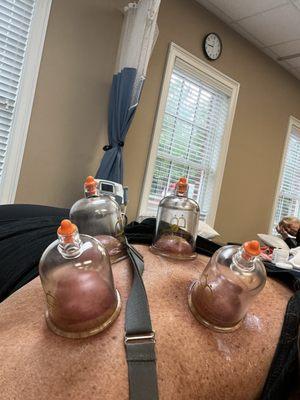 Cupping session with Nikki.