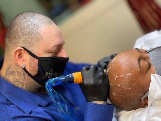 Scalp Micropigmentation (SMP) procedure