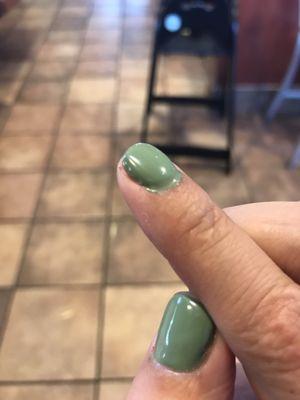 Dent on nail