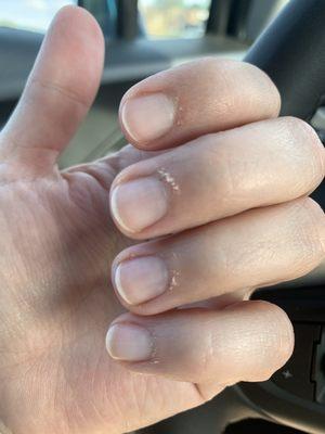 Cuticles a few days after manicure