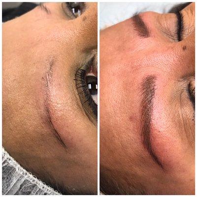 Microblading