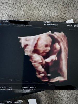 4D picture of baby