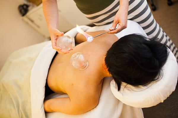 Cupping is a great way to promote circulation in targeted areas of the body to relieve pain.  Also used to reduce cold symptoms.