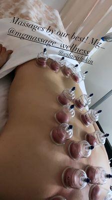 Body massage/cupping