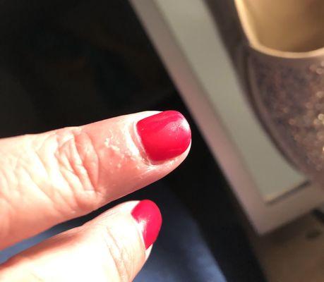 Cuticle or skin growing back in after I said don't cut cuticles.