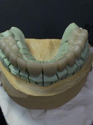 Hall Brothers Dental Lab