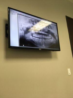 Cool X-ray on tv