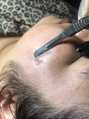 Dermaplaning Facial