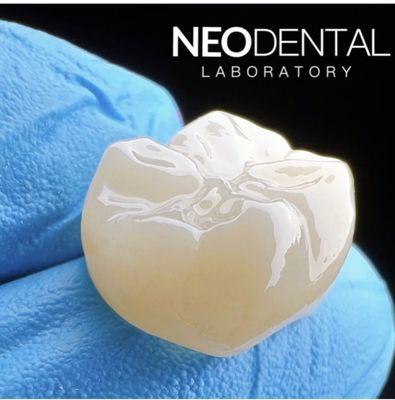 Nice and Translucent Zirconia Crowns