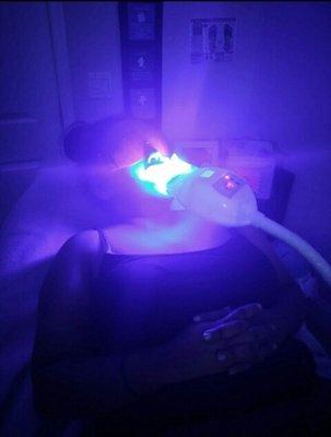 Teeth whitening offered here at Tranquil and Serene Moments