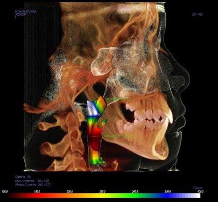 COMPLEMENTARY AIRWAY EVALUATION FOR EVERY CHILD